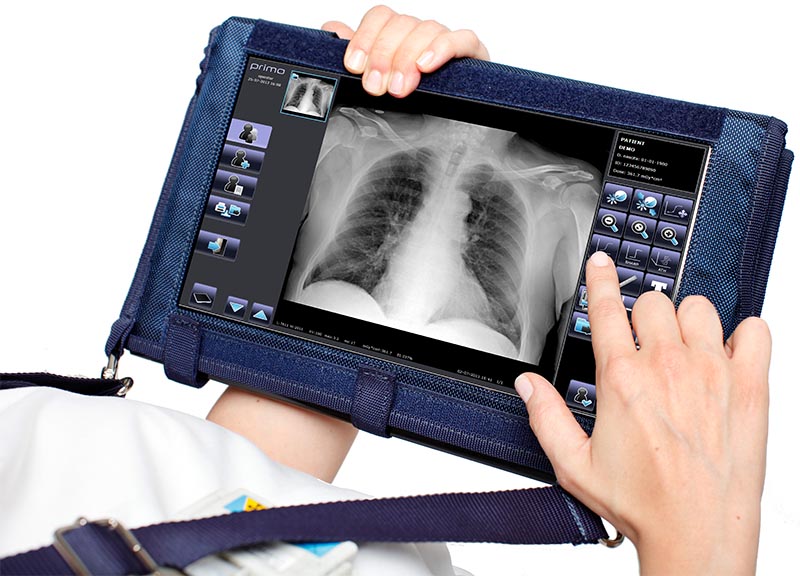 رئیس انجمن علوم پرتونگاری: حتی ماسک N۹۵ هم برای بخش رادیولوژی تعریف نشده است/ بسیاری از مراکز رادیوتراپی، فاقد ملحفه هستند/ رادیولوژیستهای فراوانی مبتلا به کرونا شده اند رئیس انجمن علوم پرتونگاری: حتی ماسک N۹۵ هم برای بخش رادیولوژی تعریف نشده است/ بسیاری از مراکز رادیوتراپی، فاقد ملحفه هستند/ رادیولوژیستهای فراوانی مبتلا به کرونا شده اند