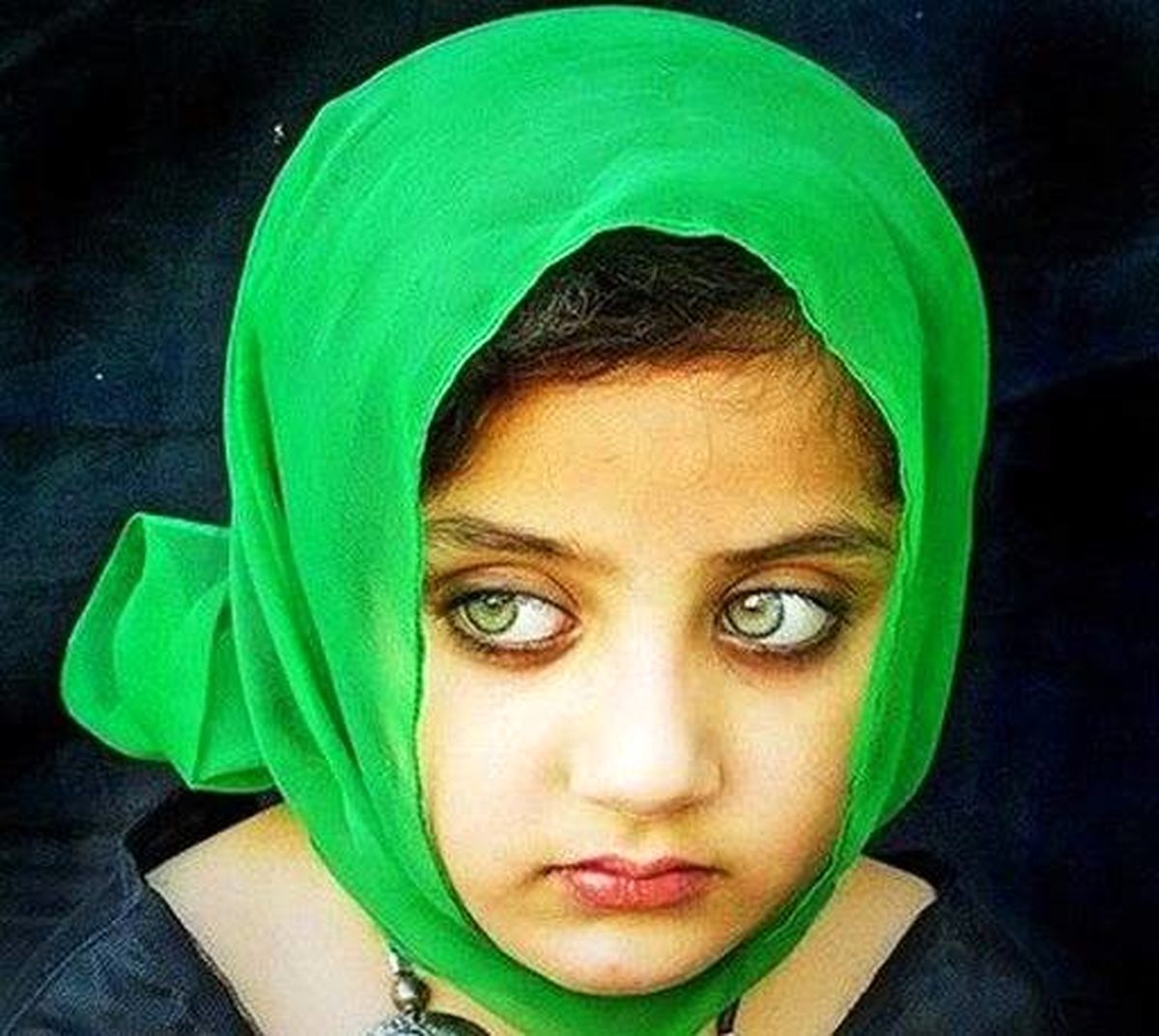 دختربچه‌ای با زیباترین چشم‌های جهان
