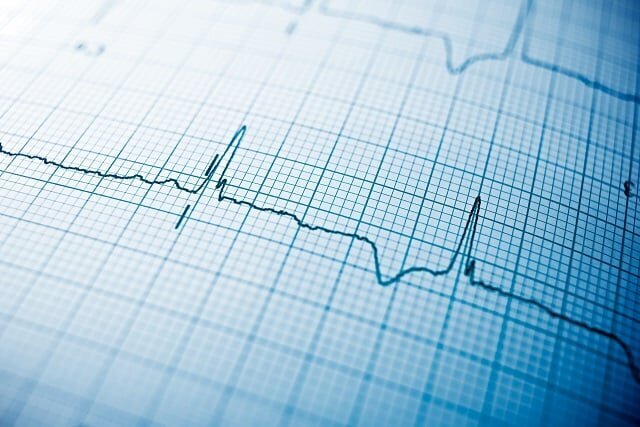 میانگین سنی فوتی‌ها در کشور اعلام شد