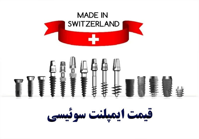 قیمت ایمپلنت سوئیسی