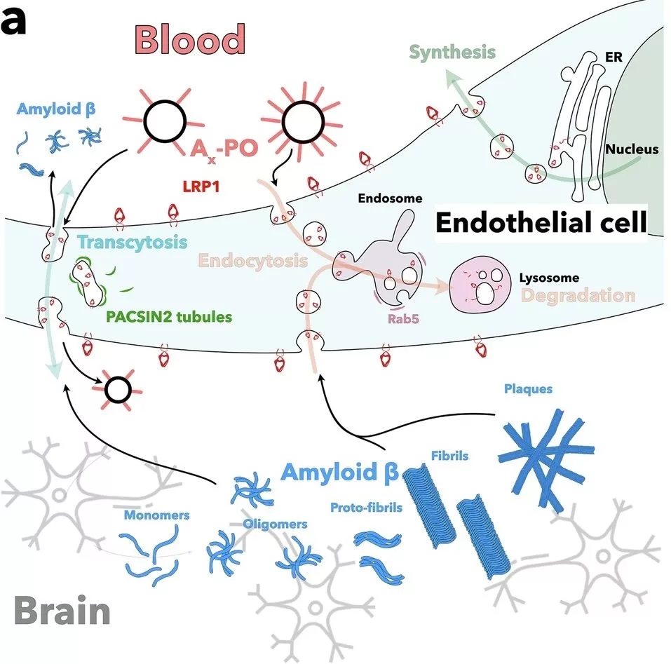 دانشمندان آلزایمر را با نانوذرات معکوس کردند دانشمندان آلزایمر را با نانوذرات معکوس کردند